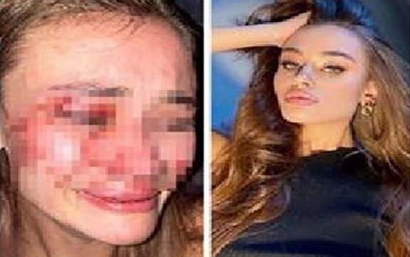 Top Modelin Darp İddialarına Mekandan Açıklama