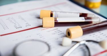 Kan Bağışı Yapmak Hayat Kalitesini Yükseltiyor