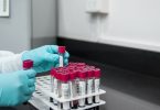 Hemofili Üzerine Türkiye’de Yapılan Araştırma Sonuçları Açıklandı
