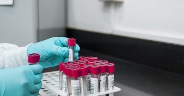 Hemofili Üzerine Türkiye’de Yapılan Araştırma Sonuçları Açıklandı