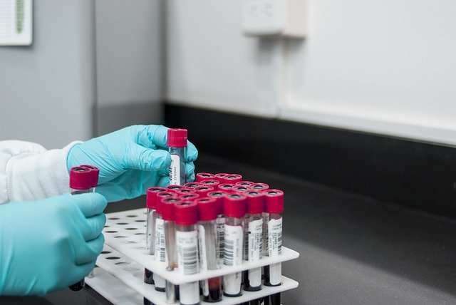 Hemofili Üzerine Türkiye’de Yapılan Araştırma Sonuçları Açıklandı
