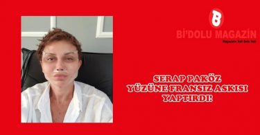 Serap Paköz Yüzüne Fransız Askısı Yaptırdı